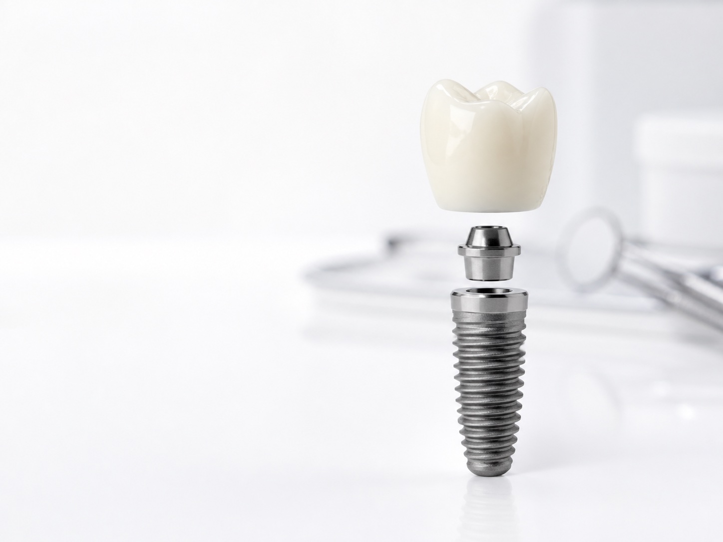 Model de implant dentar