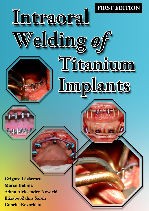 Coperta cărții Intraoral Welding of Titanium Implants
